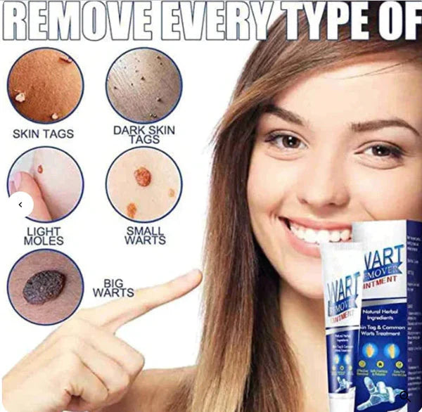 Instant Wart Remover (Buy 1 Get 1 Free)